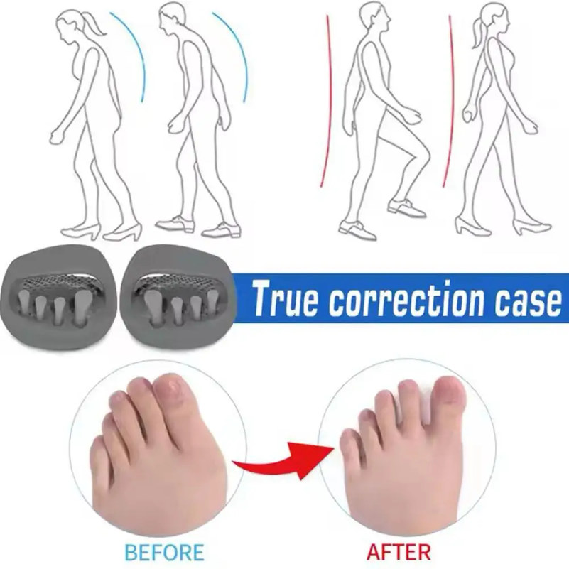 Leg Correction Slippers Scient - огляд і ціна Home Improvement Man